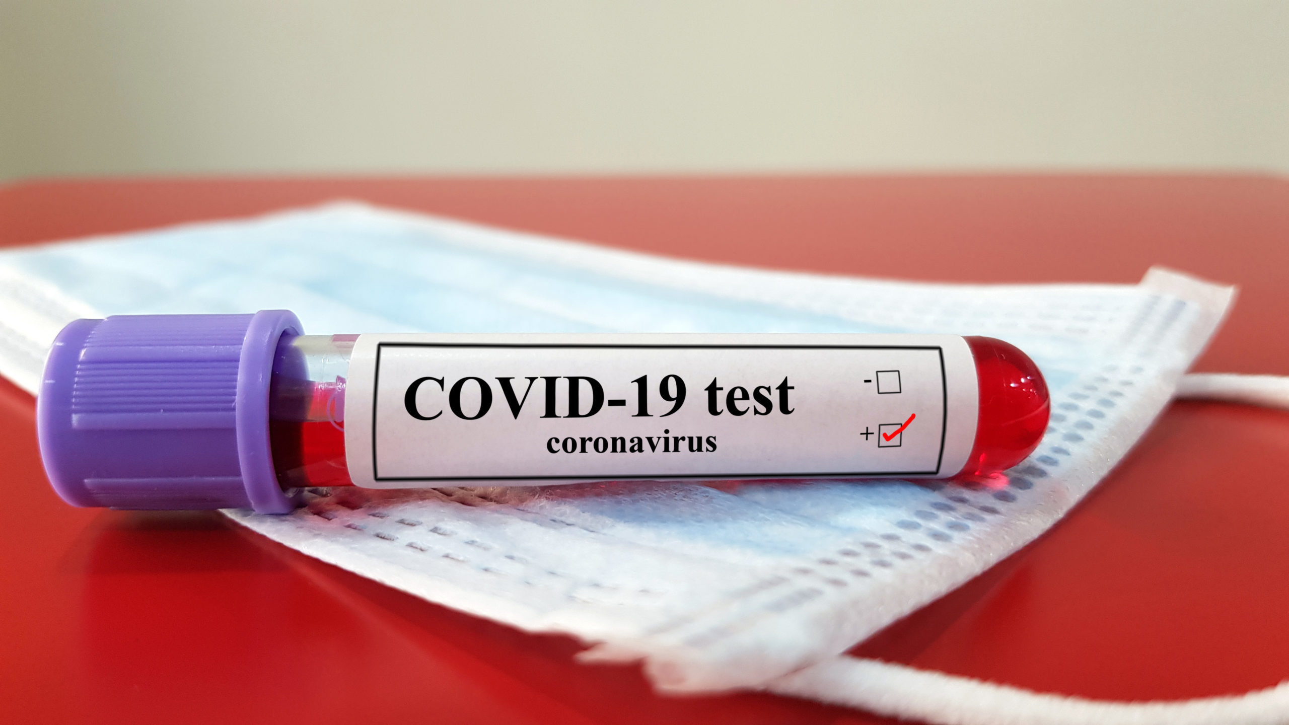 Coronavirus (COVID-19) Testing