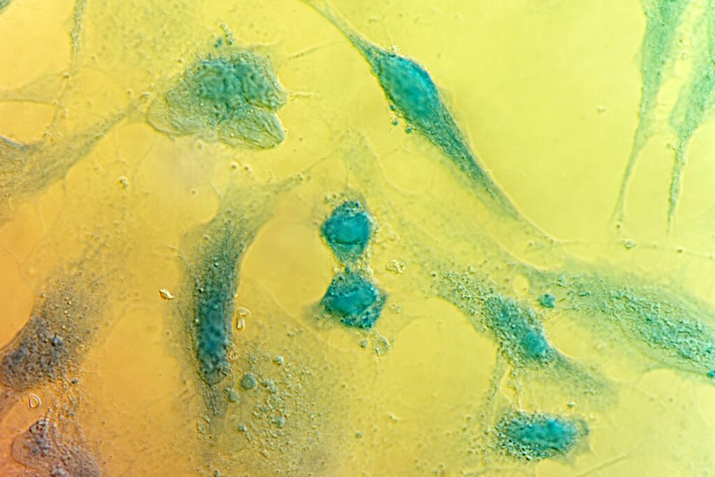 HeLa cervical cancer cells